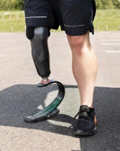 Custom Foot Orthotics in Beaumont